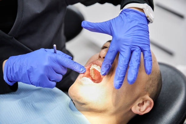 Best Broken or Chipped Tooth Repair in Sonora, TX